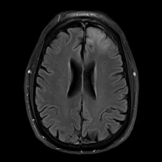 fastMRI Dataset Release - Brain MRI Scan
